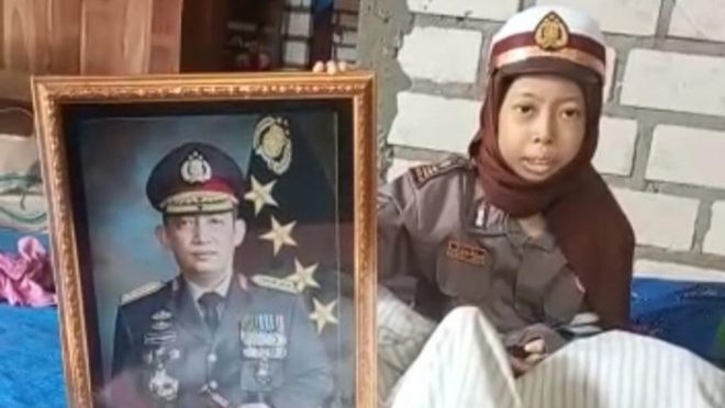 Kapolri Merespon Permintaan Sinta Aulia, Anak Penderita Tumor Kaki