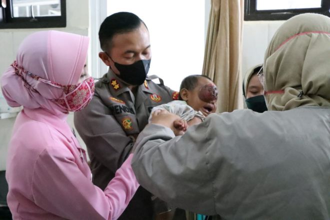 Kisah Haru Kapolres Banjarnegara Jemput Nuzailla Bocah 17 Bulan Penderita Tumor Mata Sebesar Bola Tenis